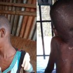 11-Year-Old Househelp Who Was Beaten And Fed With Cockroaches And Faeces By Her Boss, Has Been Rescued (photos)
