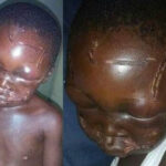 Very Disturbing Photos Of A 7-Year-Old Boy Who Was Gruesomely Beaten By His Stepfather