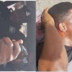 Photos Of PUNCH Journalist Who Was Brutalized By Policemen At Lagos’ October 1 Protest