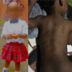 Lagos State Govt Seals School Where 2-year-old Was Allegedly Flogged Mercilessly by Her Teacher